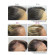 Viviscal Maximum Strength Hair Growth Supplement