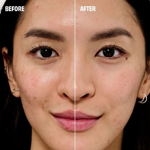 BENEFIT COSMETICS The Porefessional On Lock Set