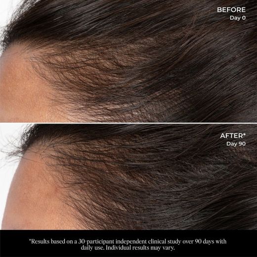 LOLAVIE Hair Scalp Serum