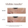 IROHA NATURE Iroha Eye Pad 