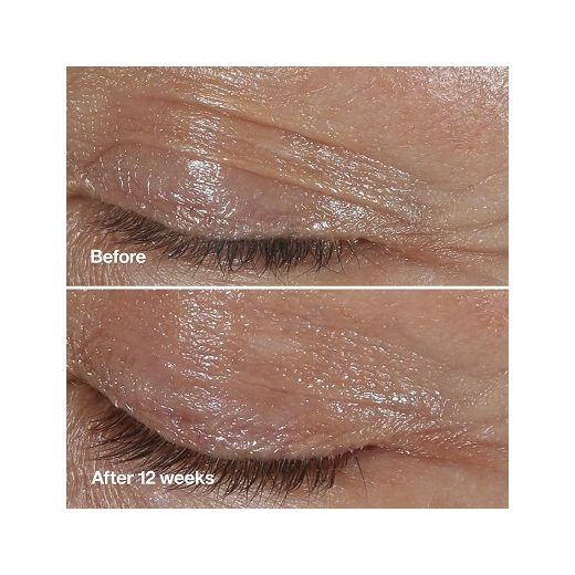 Clinique Smart Clinical Repair™ Wrinkle Correcting Eye Cream