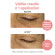 IROHA NATURE Anti-Fatigue And Illuminating Sheet Eye Patches With Vitamin C