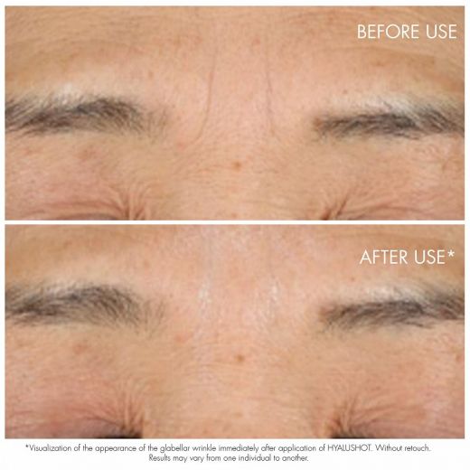 DIOR Capture Totale Hyalushot