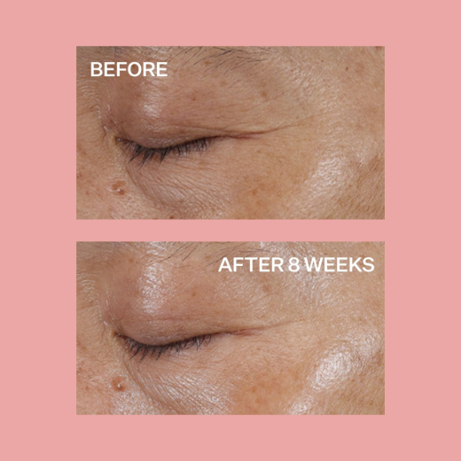 STRIVECTIN Super-C Vitamin C Eye Cream 