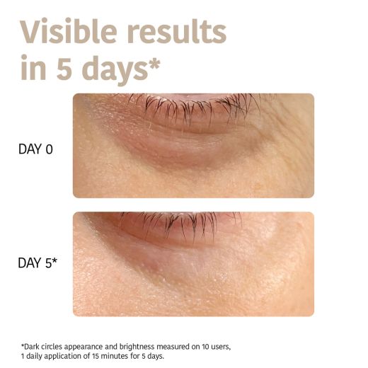 IROHA NATURE Eye Patches With Niacinamide Caffeine And Peptides